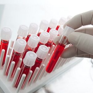 Аналіз; Chlamydia spp.; кров; ІФА, Ig М. Забір крові для лабораторних досліджень.