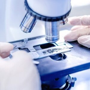 Аналіз; секрет передміхурової залози; мікроскопія на склі. Забір секрету передміхурової залози для лабораторних досліджень.