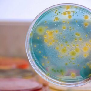 Посів виділень зі статевих органів; уреоплазмоз, мікоплазмоз; якісне визначення.